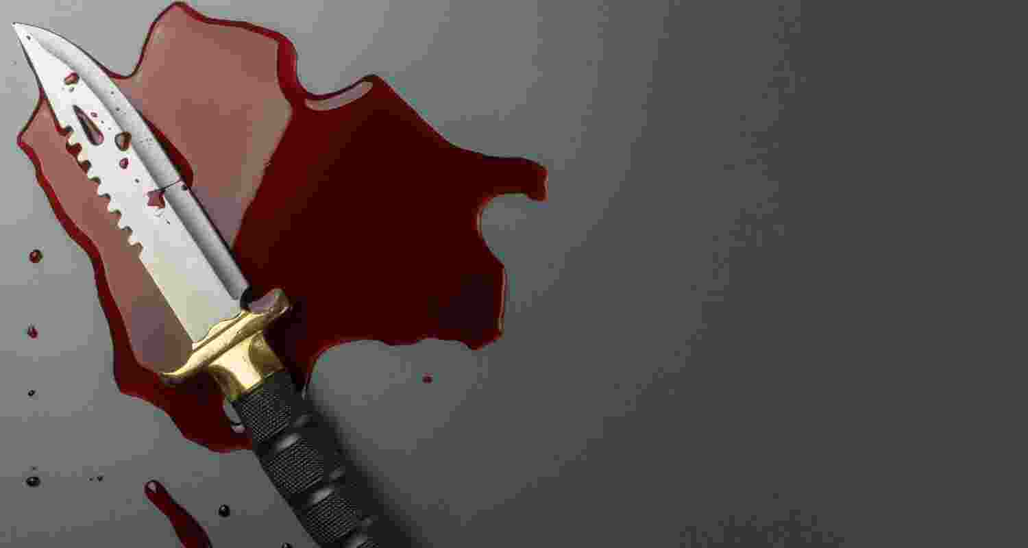 Representative Image. 