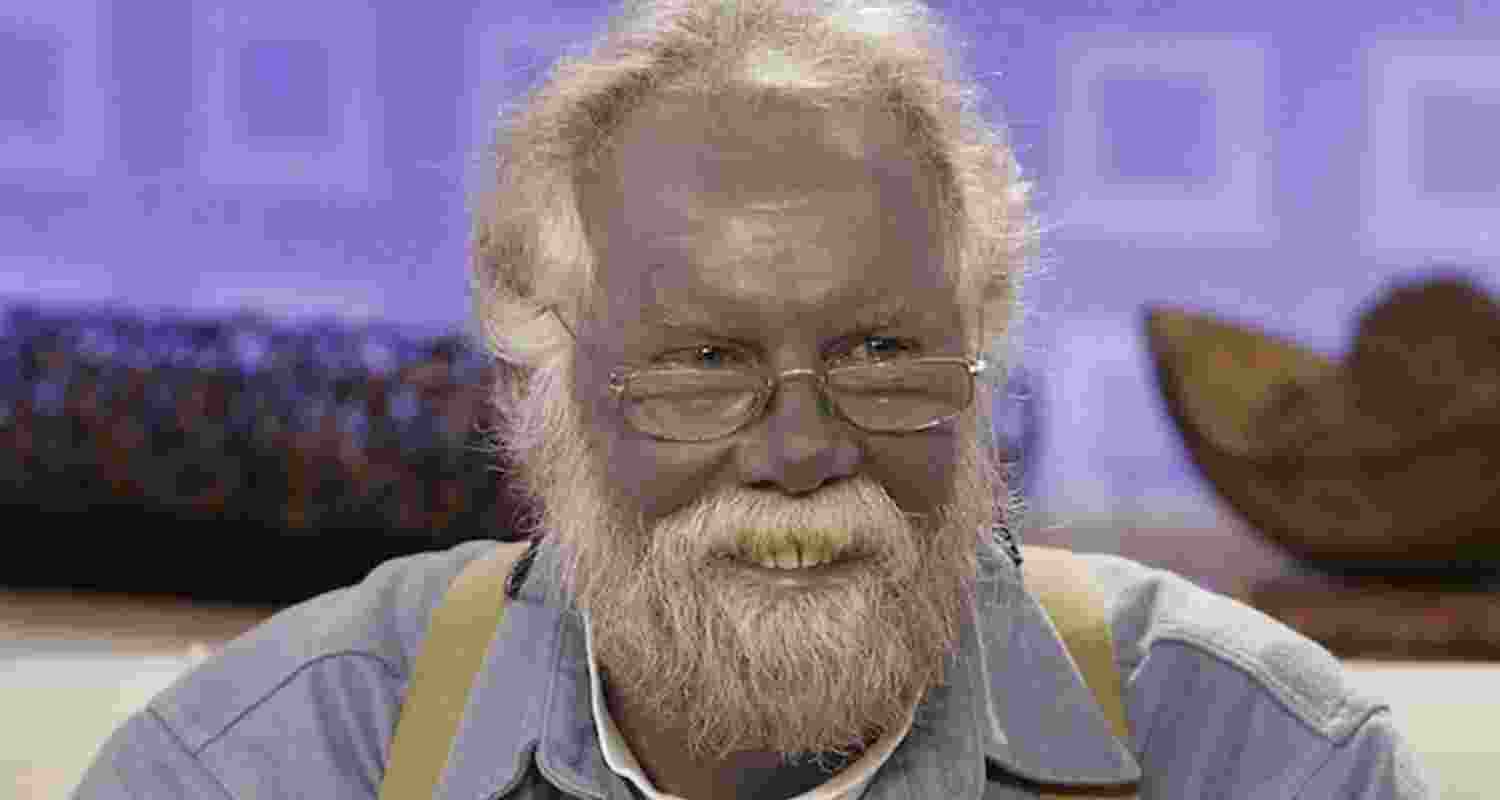 Paul Karason, an American man, became famous for his unusual blue skin colour. He developed a condition called argyria after he self-medicated with homemade silver chloride solution. Image: X