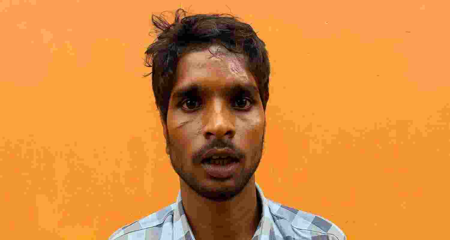 Rahul Singh, a resident of Nalhati municipality in Birbhum district, lost both ears in the attack.