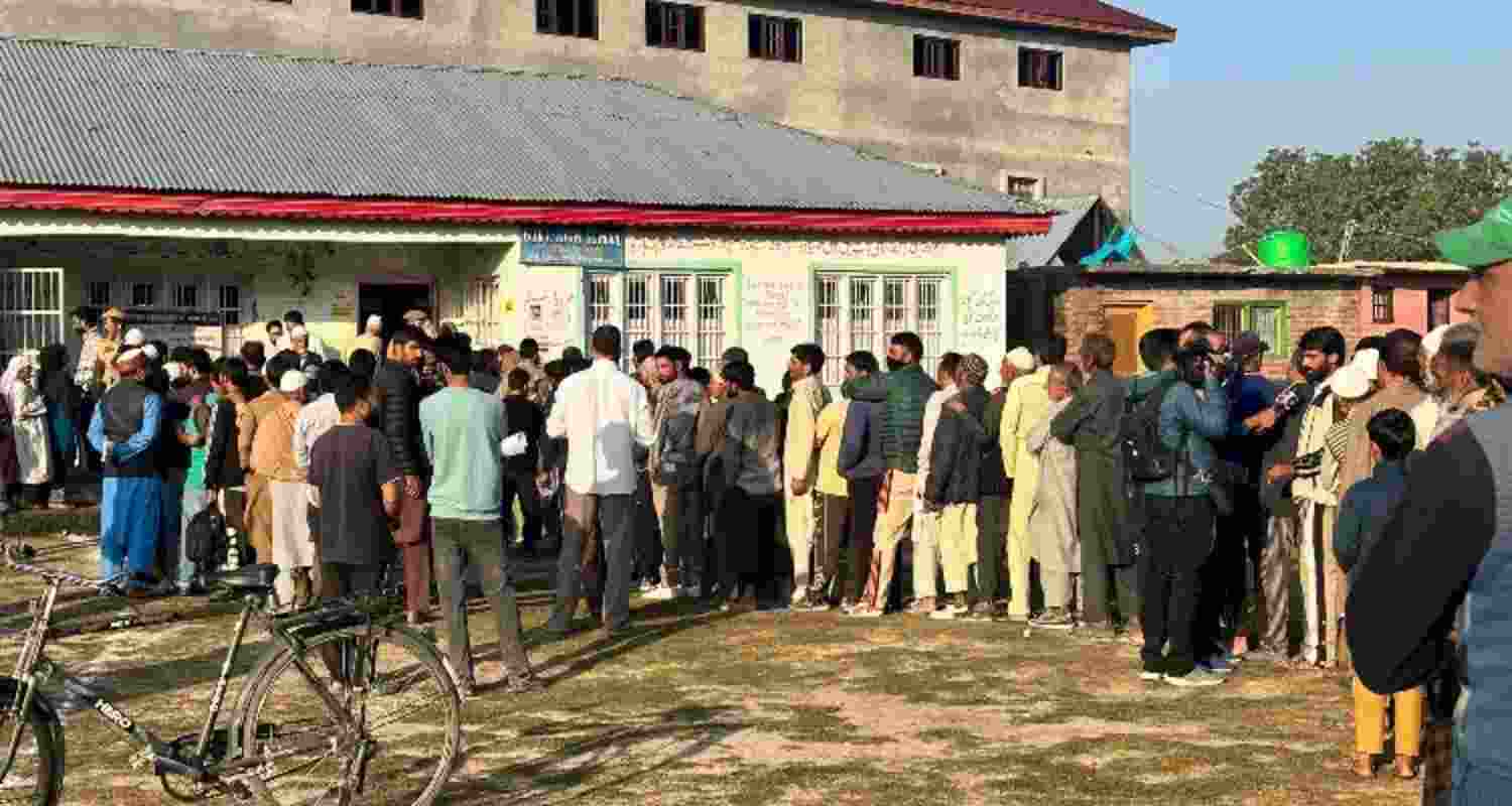 Representational Image. 