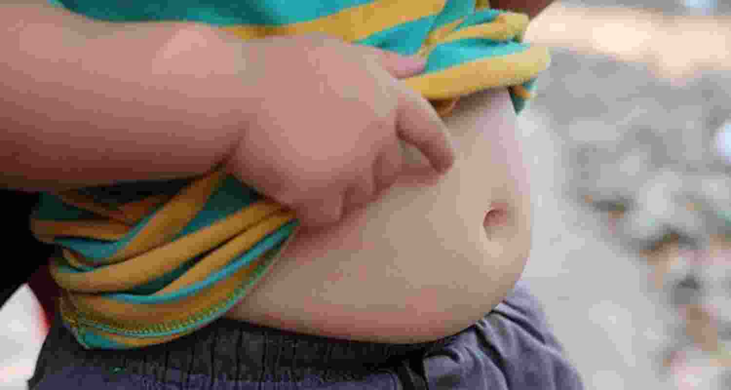 Representational image.