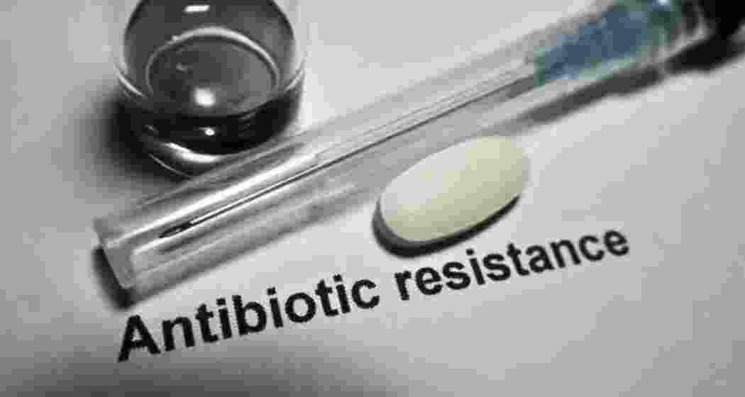 Representational image.