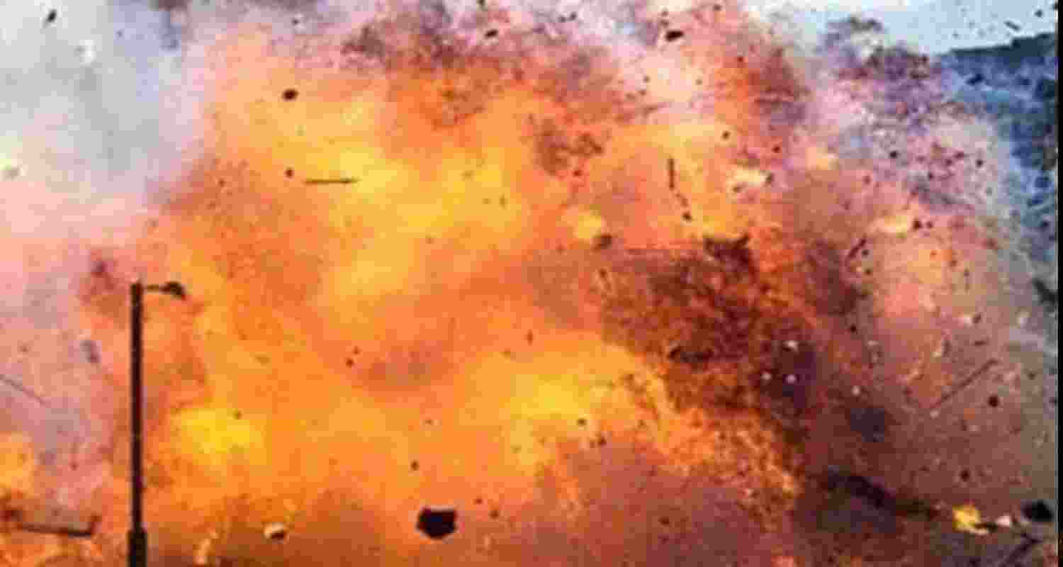 Representational Image.