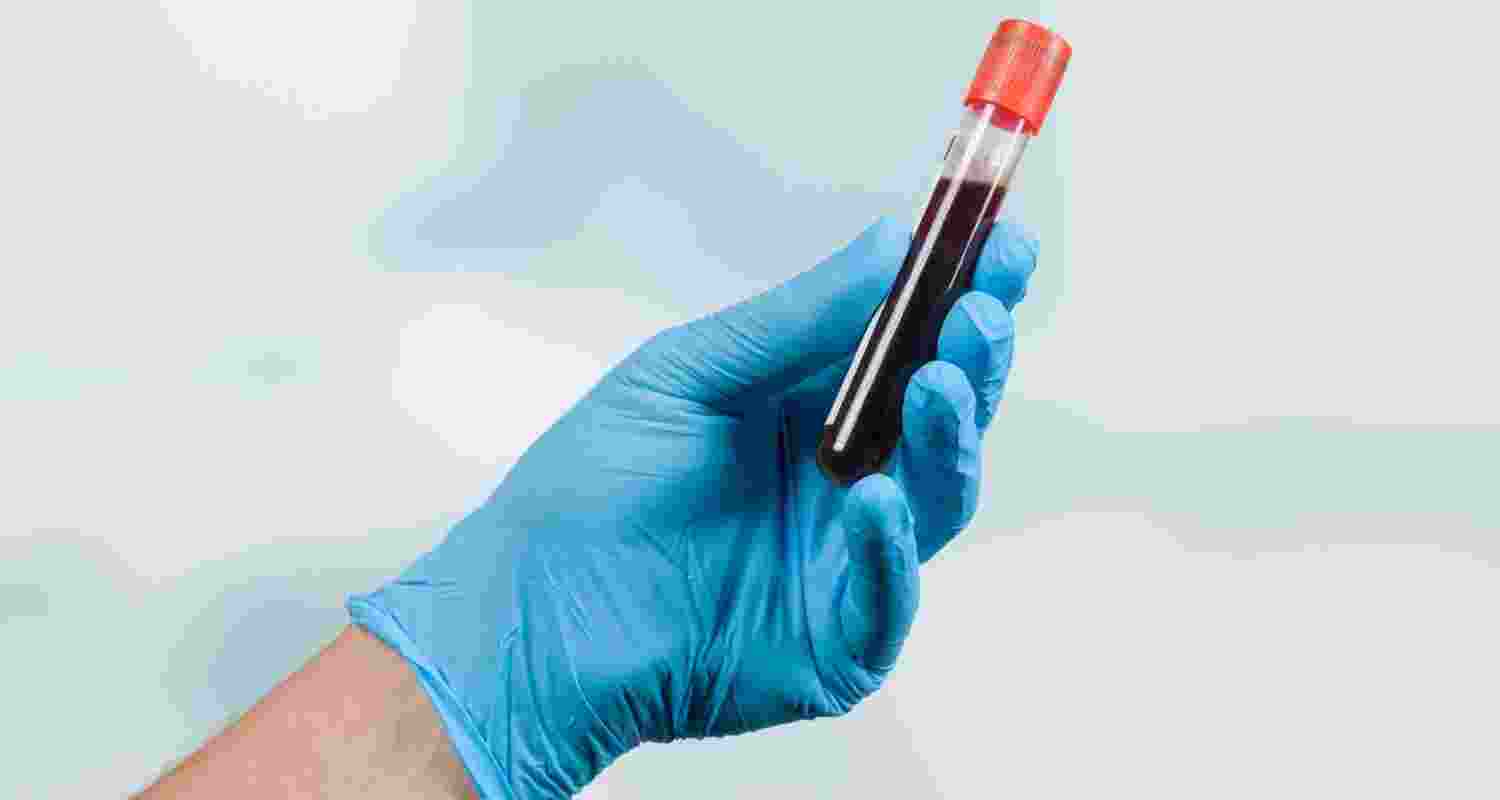 New AI tool refines blood test norms for patients