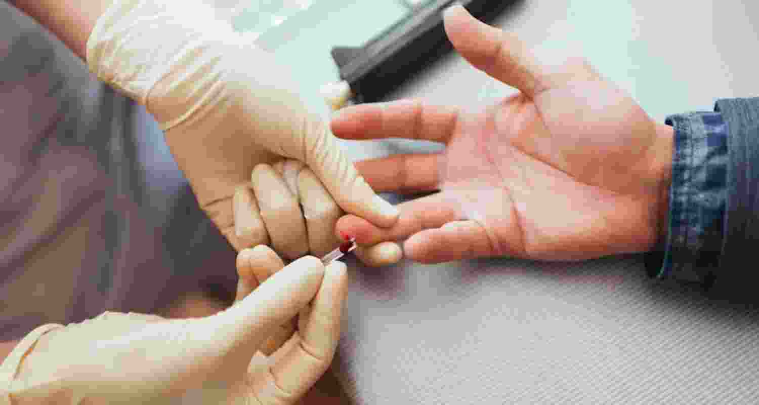 Representational image.