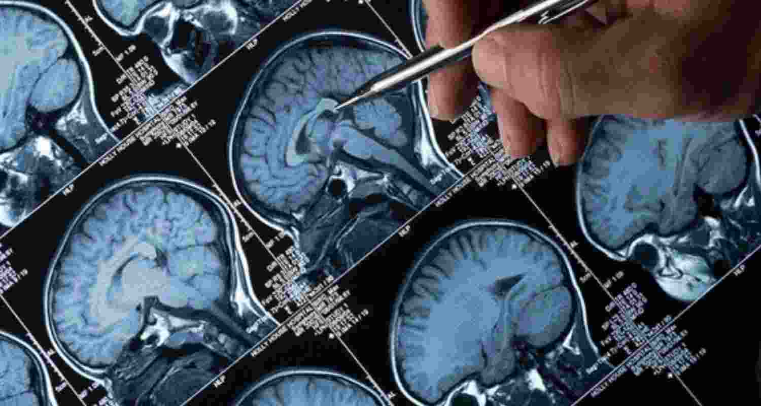 Kerala leads in nation's fight against amoebic brain fever