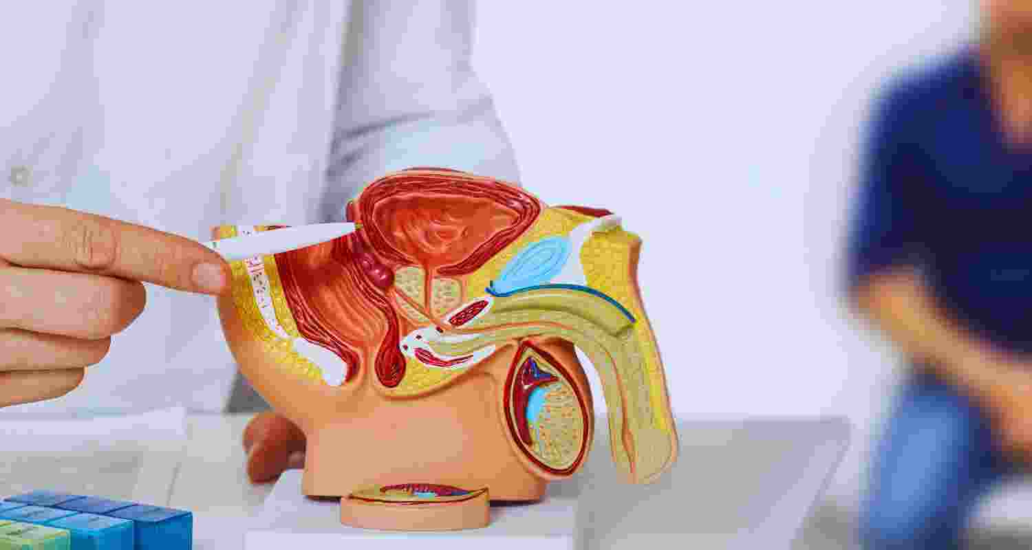 What is Prostate cancer? Is it curable?