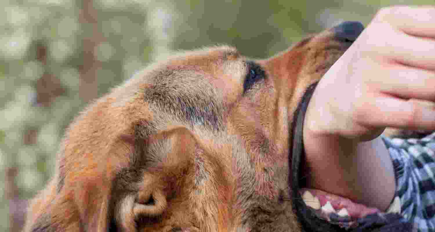 Representative Image. 