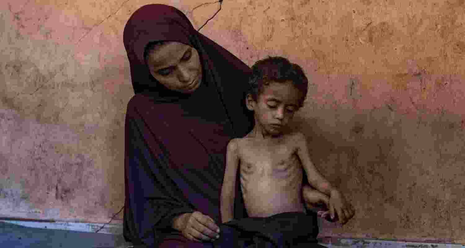 Malnutrition is rife. According to the IPC’s report in May, “goods indispensable for people’s survival are either depleted or expected to run out in the coming weeks."