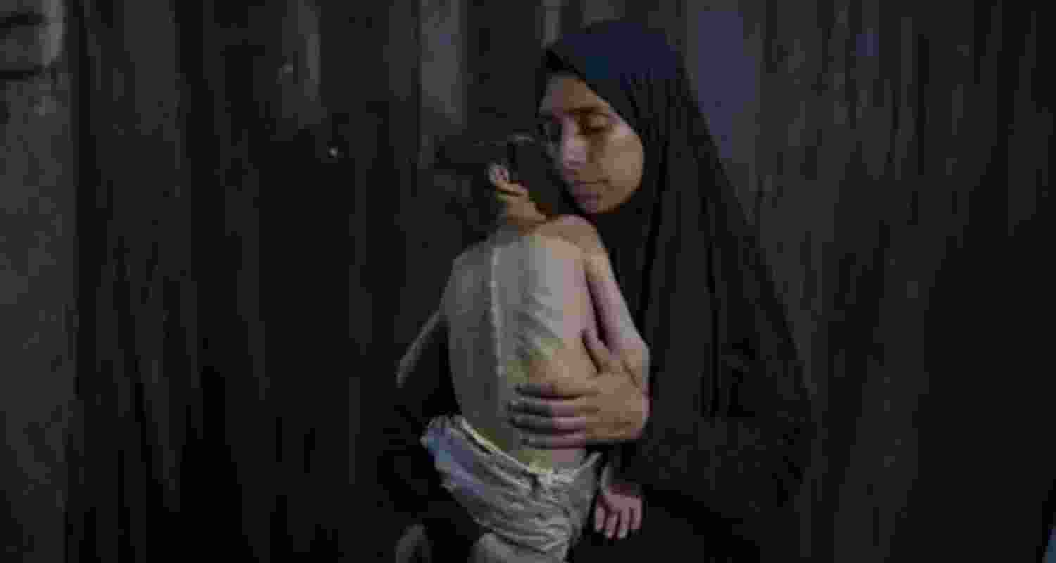Samah Matar with her son Yousef, 6, who suffers from malnutrition and cerebral palsy, photographed on July 26.