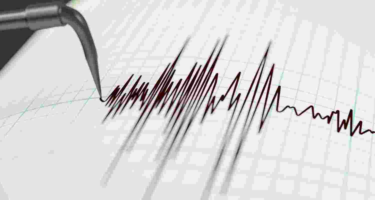 Representative Image. 