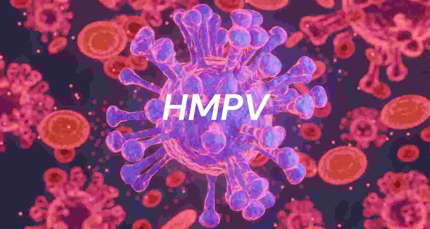 Representative Image. 