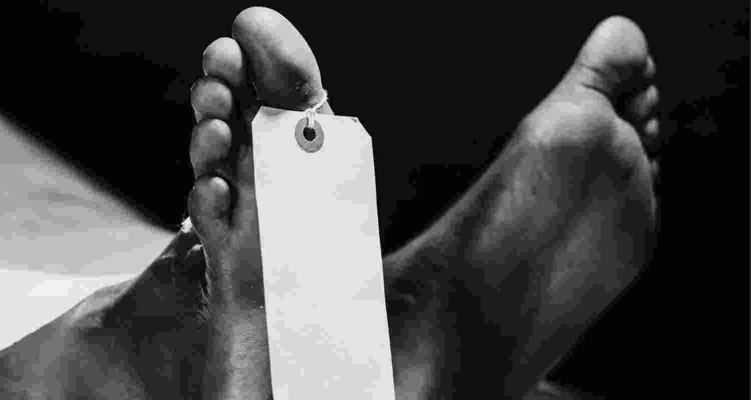 Representative Image. 