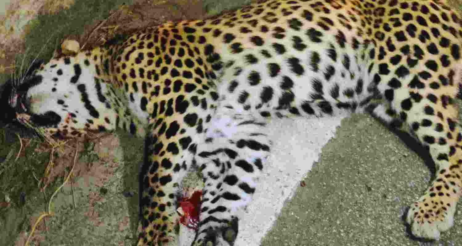 Representative Image. 