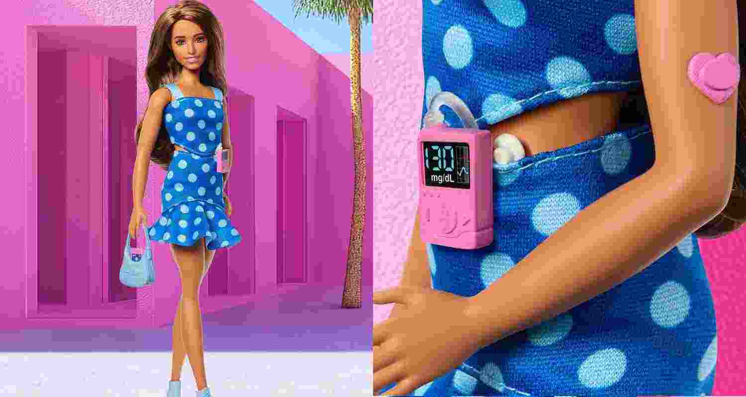 Barbie's new look says - diabetes doesn't define you