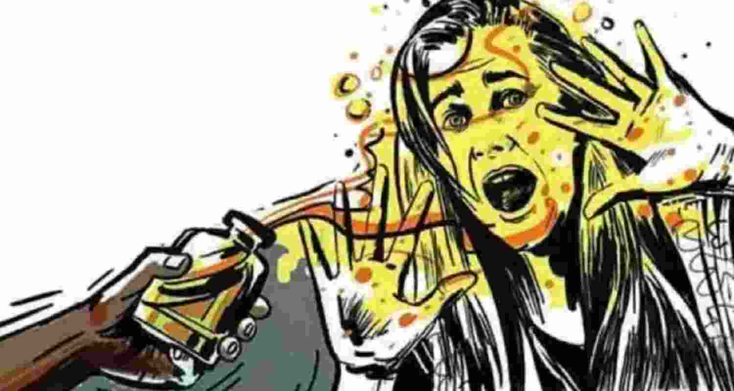 Representational image. 