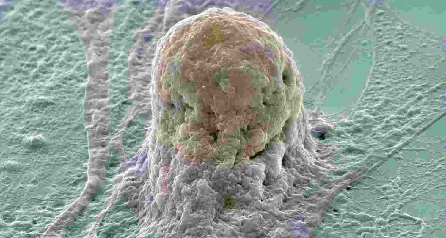 Stem cells: The future of diabetes care