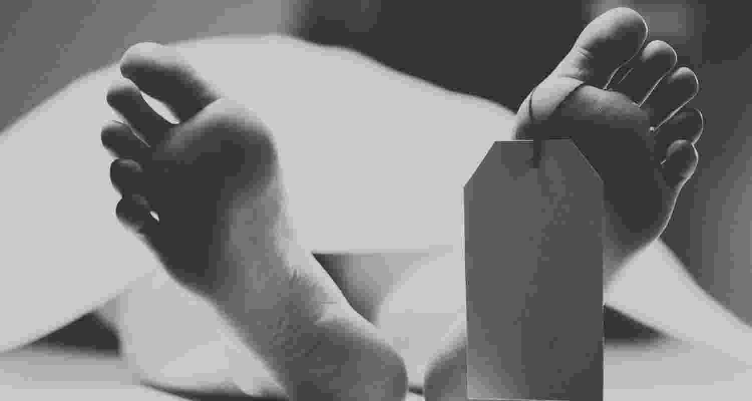 Representative Image. 