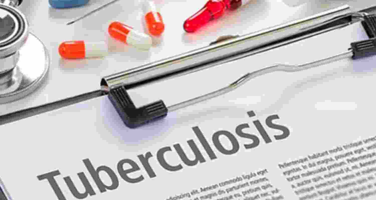 121 people died of tuberculosis in Mizoram since January