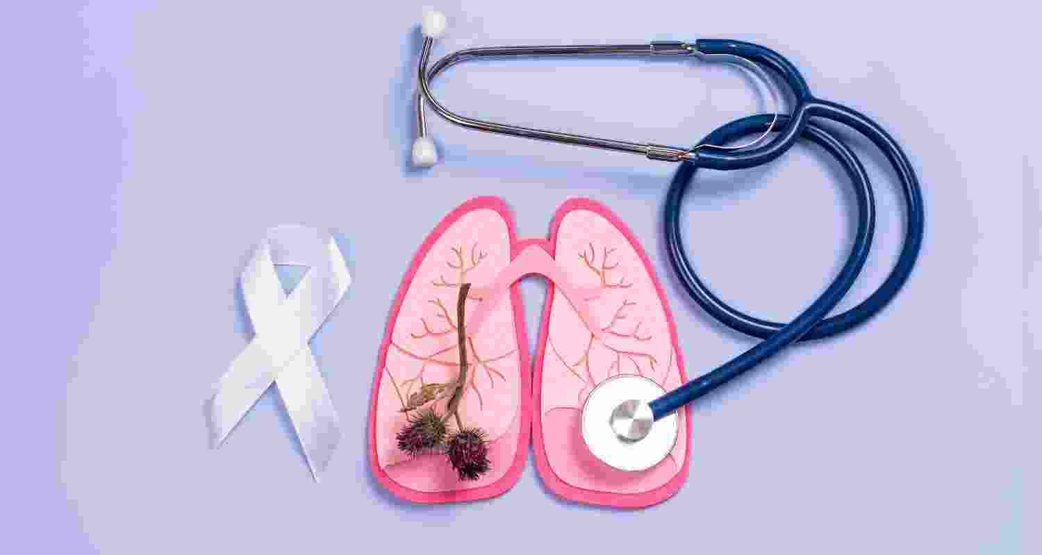 Representative Image. 