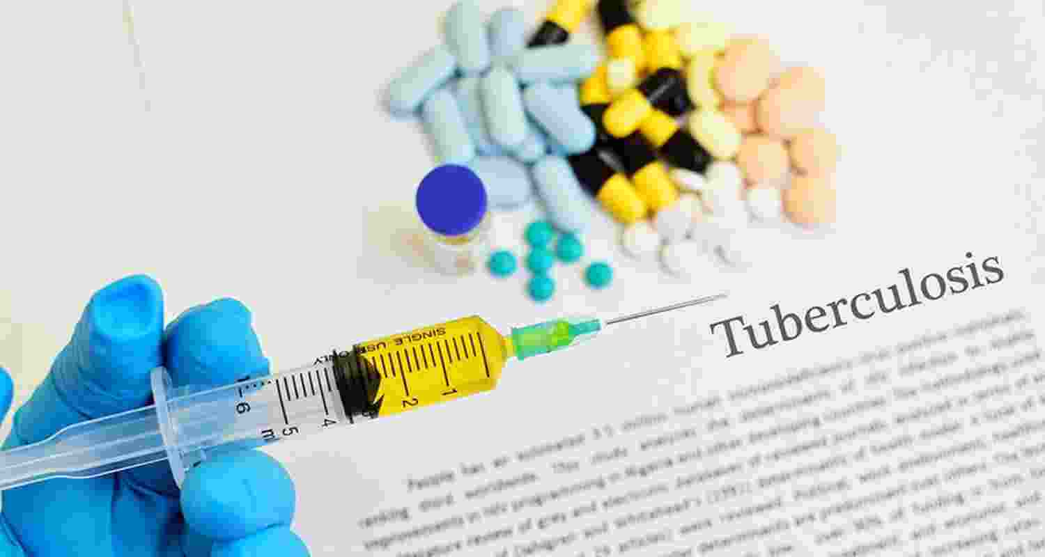 In a first, Tamil Nadu to implement TB death prediction model