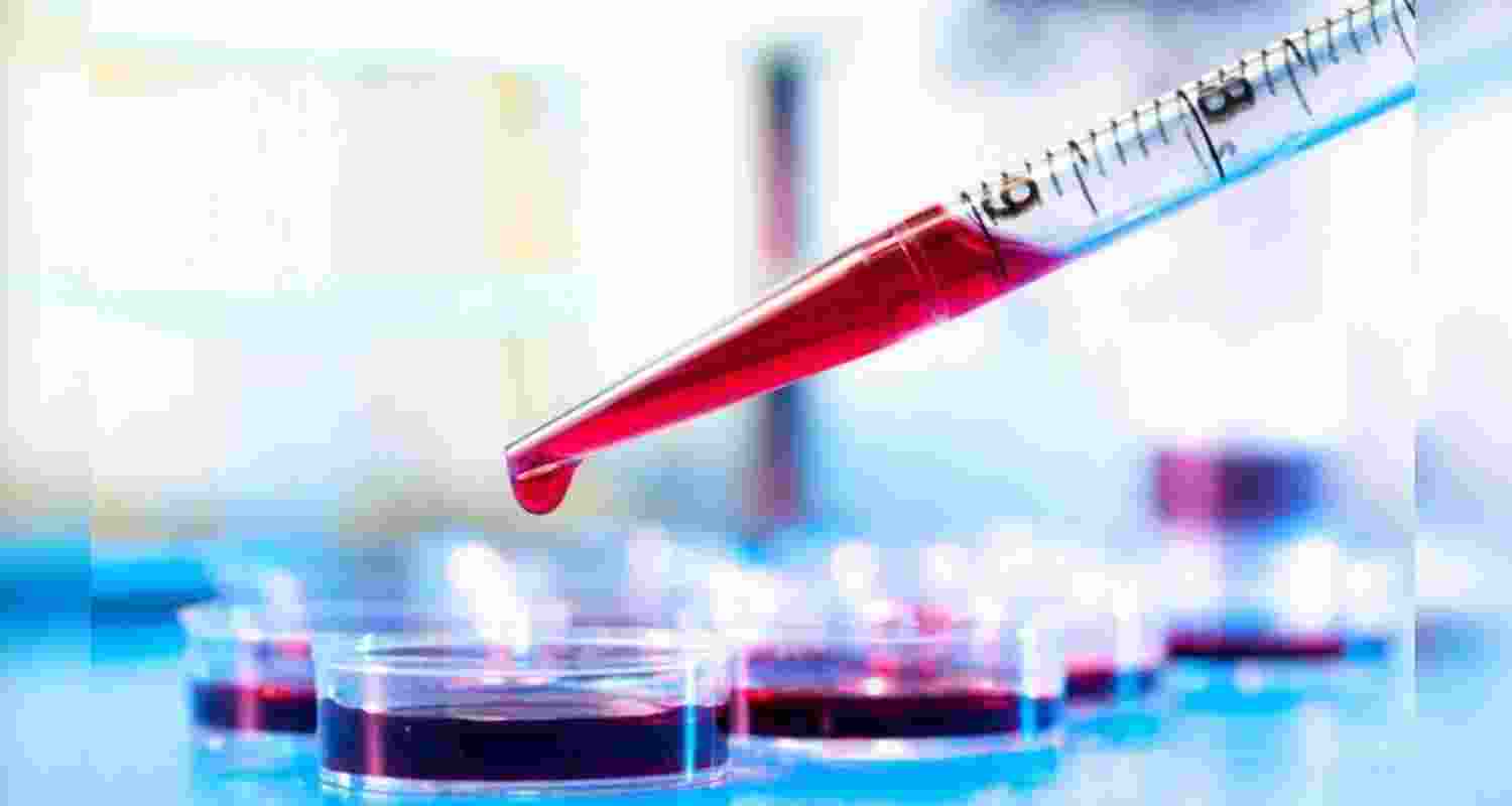 Jharkhand to launch statewide Thalassemia, Sickle Cell screening