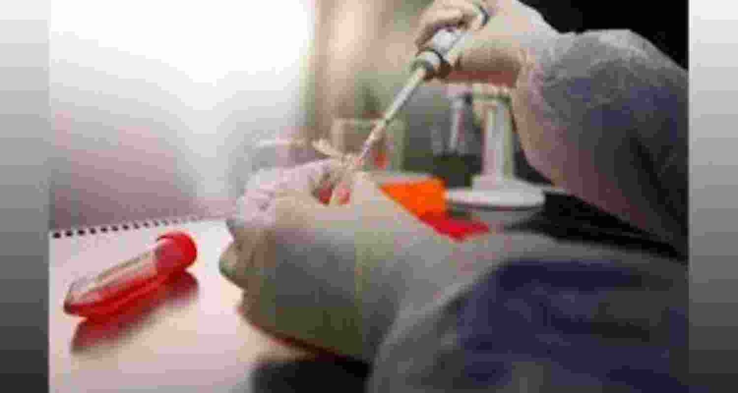 Representative Image