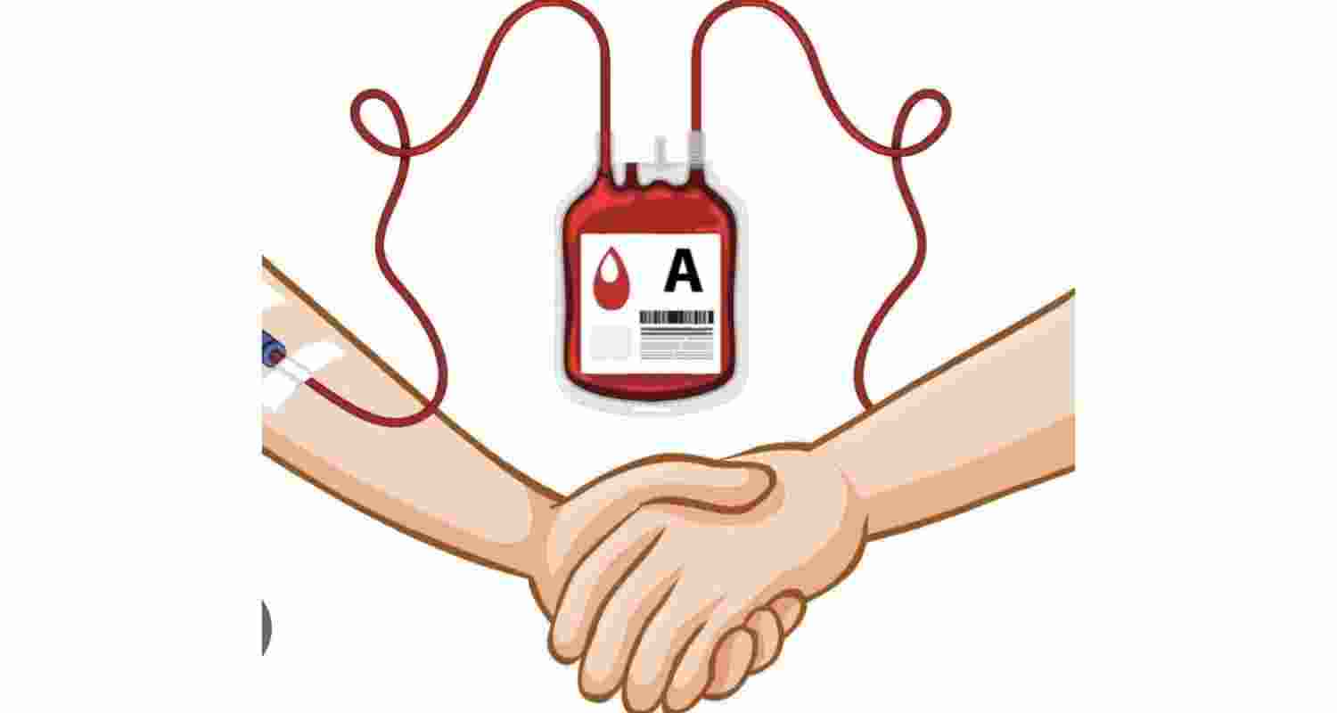 Represntational image. Represntational image.