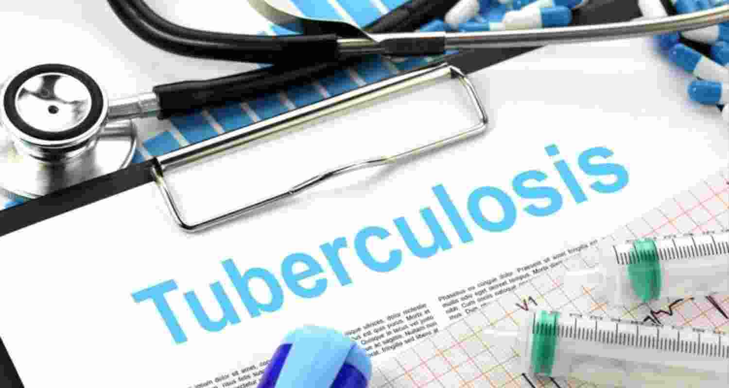Mizoram records highest TB deaths in 6 years; 145 in 2025 Mizoram records highest TB deaths in 6 years; 145 in 2025