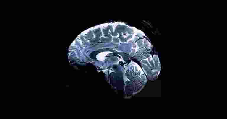 The world's most powerful MRI scanner has unveiled the first-ever images of the human brain, promising unprecedented insights into its complexities and associated afflictions. The world's most powerful MRI scanner has unveiled the first-ever images of the human brain, promising unprecedented insights into its complexities and associated afflictions.