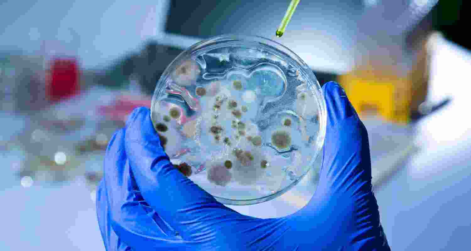 Congo declares Ebola outbreak, reports 15 deaths Congo declares Ebola outbreak, reports 15 deaths