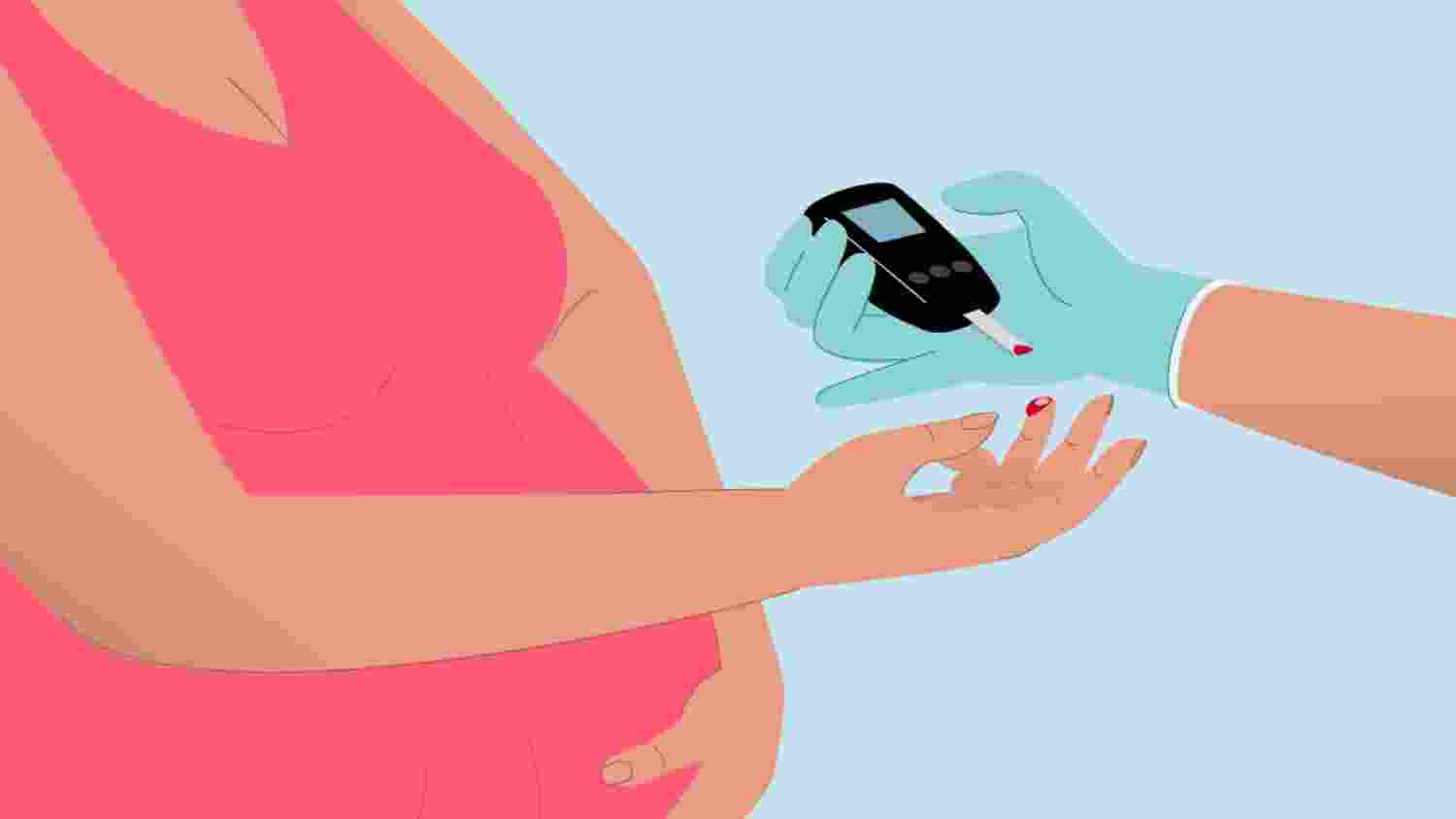 Early gestational diabetes care prevents complications Early gestational diabetes care prevents complications