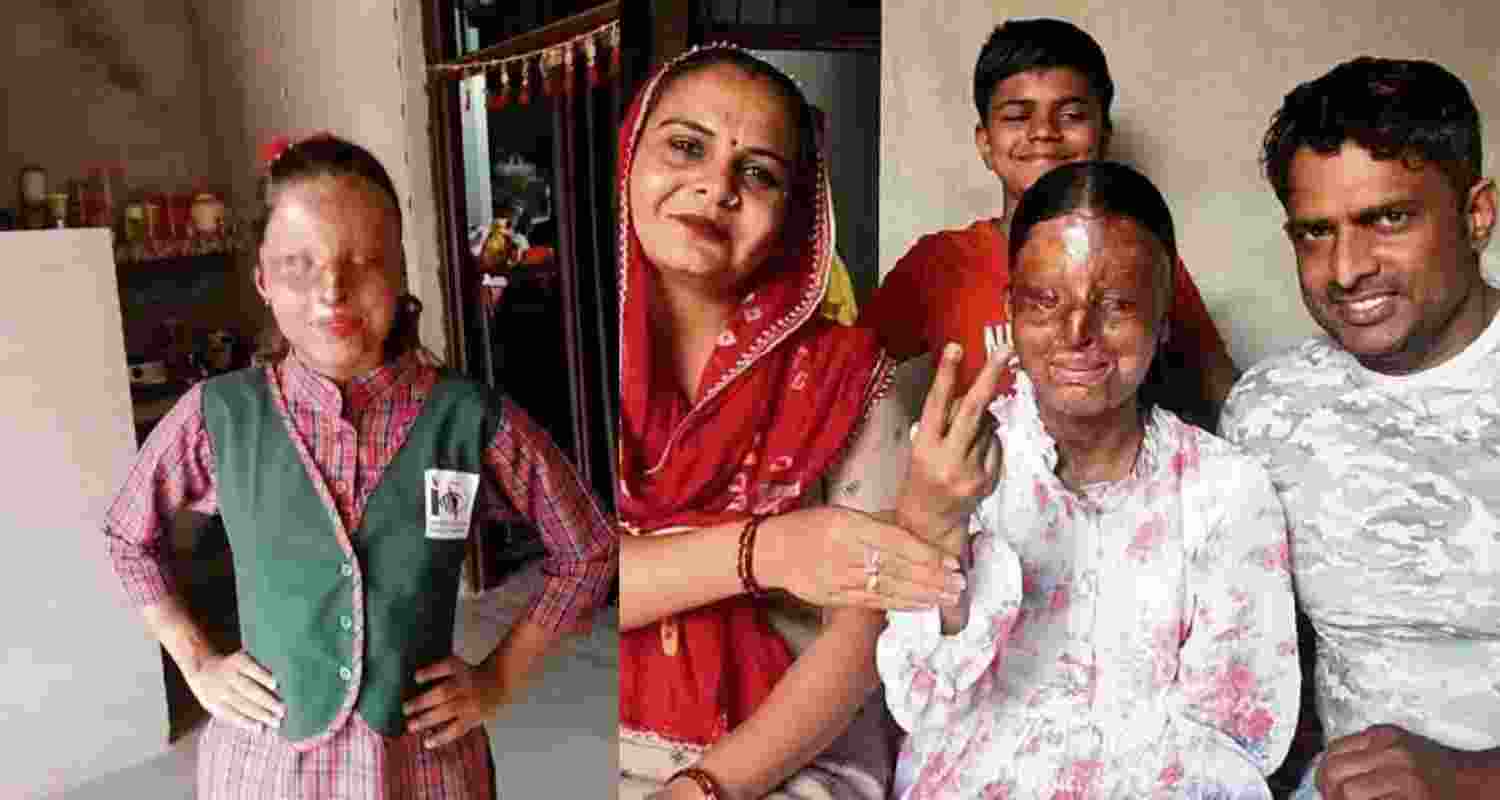 Kafi, an acid attack survivor from Chandigarh, emerged as the topper of her school in the CBSE class 12 exams. Kafi, an acid attack survivor from Chandigarh, emerged as the topper of her school in the CBSE class 12 exams.
