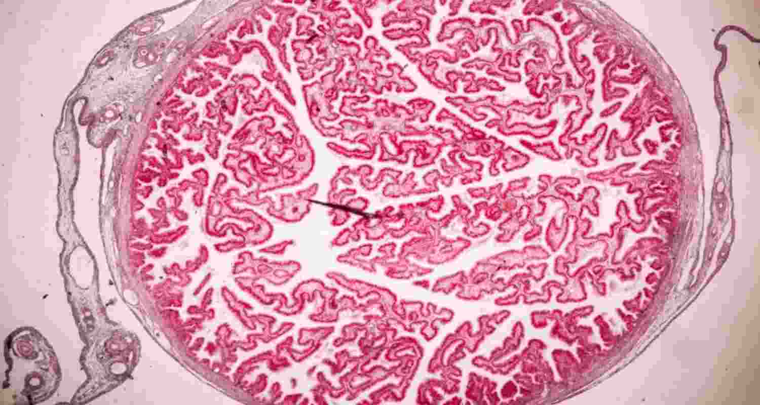 Placenta rights: Why mothers should decide its future Placenta rights: Why mothers should decide its future