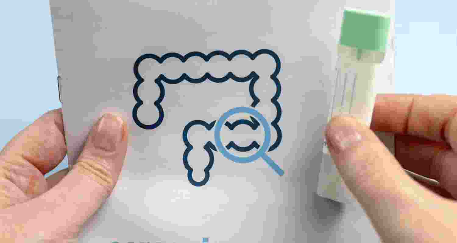 Poop and blood tests approved for colon cancer screening Poop and blood tests approved for colon cancer screening