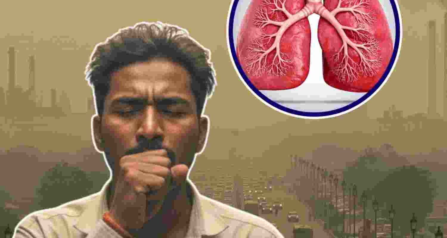 Delhi doctors report 20-30 pc jump in respiratory cases Delhi doctors report 20-30 pc jump in respiratory cases